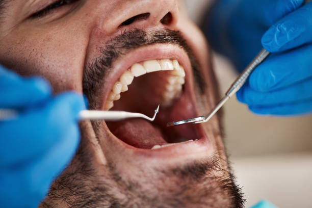 Best Emergency Tooth Extraction  in Chrisman, IL